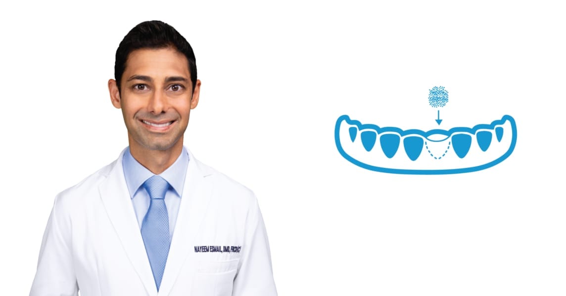 What is bone grafting in Abbotsford, BC?